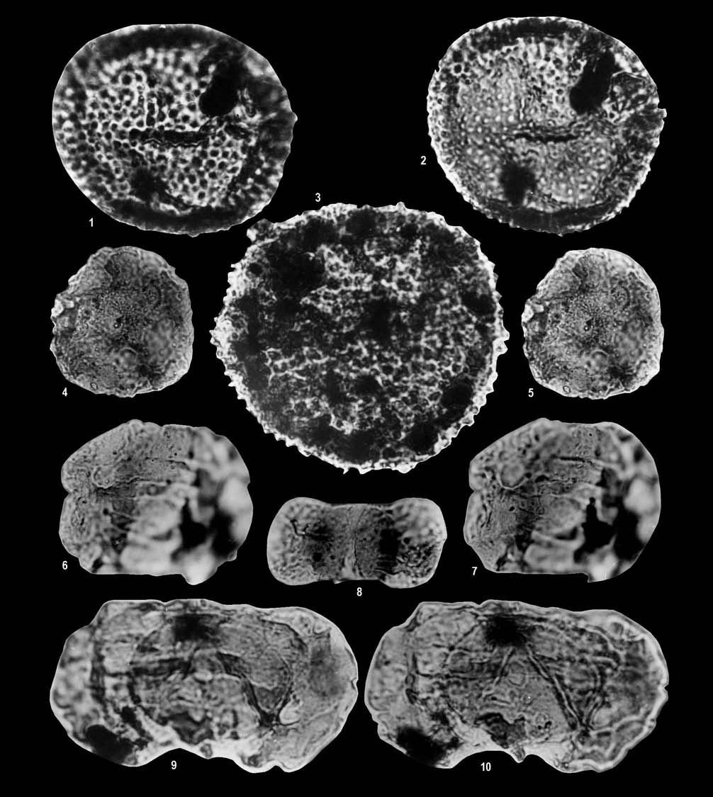 A Mecsek hegység felső-triász képződményei 101 III. tábla Plate III 1 2. Porcellispora longdonensis, Hu 2 fúrás, 684,5 m (ladin) 3. Porcellispora longdonensis, Hu 2 fúrás, 660,4 m (ladin) 4 5.