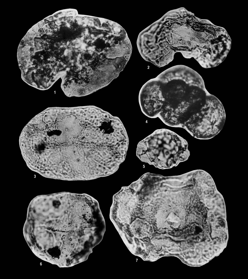 102 NAGY ELEMÉR et al. IV. tábla Plate IV 1. Infernopollenites sulcatus, Hu 2 fúrás, 660,8 m (ladin) 2. Striatoabieites sp., Hu 2 fúrás, 684,5 m (ladin) 3.