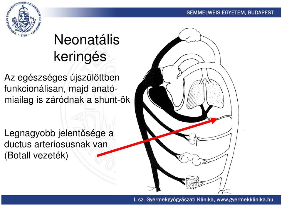 miailag is záródnak a shunt-ök Legnagyobb