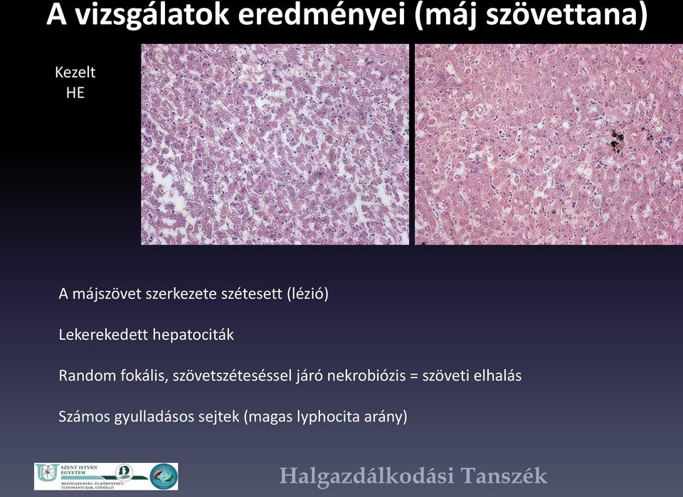 hepatociták Random fokális, szövetszéteséssel járó