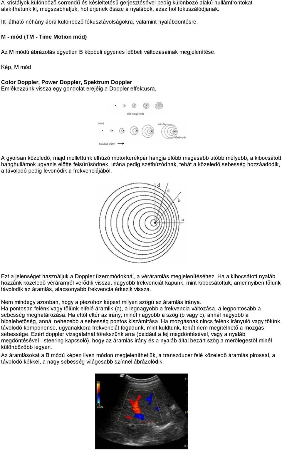 Kép, M mód Color Doppler, Power Doppler, Spektrum Doppler Emlékezzünk vissza egy gondolat erejéig a Doppler effektusra.