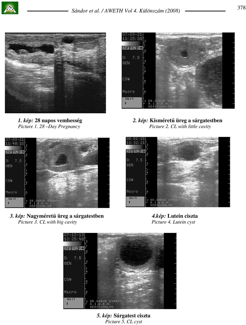 28 Day Pregnancy Picture 2. CL with little cavity 3.