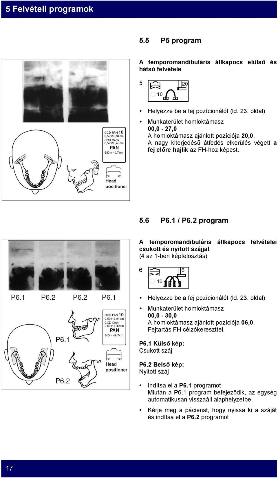 2 program A temporomandibuláris állkapocs felvételei csukott és nyitott szájjal (4 az 1-ben képfelosztás) 6 Helyezze be a fej pozícionálót (ld. 23.