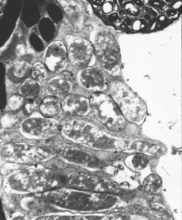 NODULÁCIÓ növényi jel Rhizobium