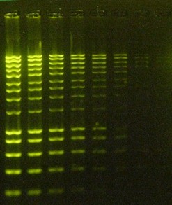 etídium bromid + UV megvilágítás Az újabb DNS-hez kötődő festékek nem toxikusak és