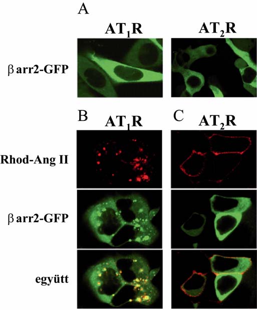 17. ábra Az AT 1 R és az AT 2 R β- arresztin2 kötése βarr2-gfp-t és AT 1 R-t vagy AT 2 R-t expresszáló HEK-293 sejtekben látható a βarr2-gfp lokalizációja kontroll körülmények között (A), és 20 perc