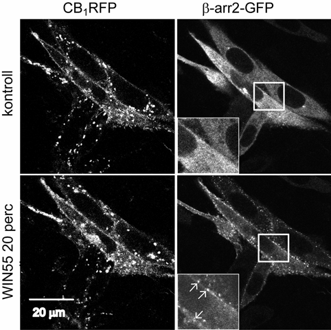 A B és C panelen felül látható a Rhod-Ang II, középen a βarr2-gfp, alul pedig ezeknek az egymásra vetített képe, ahol a kolokalizáló struktúrák sárga színűek.