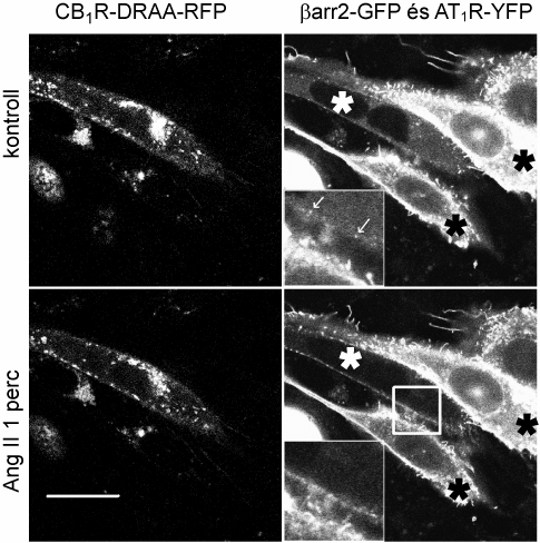 22.ábra βarr2-gfp lokalizációja CB1R-DR/AA-RFP-t expresszáló CHO sejtekben CB1R-DR/AA-RFP-t és βarr2-gfp-t koexpresszáló sejteket stimuláltunk Ang II-vel (középen) majd WIN55,212-2-vel (jobb oldal).