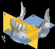 vizsgálat CT felvétel (Computer Tomography) Mágneses rezonancia frekvencia analízis y z Képanalízis