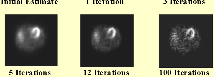 9 SPECT/CT - 2008. márc. 27.