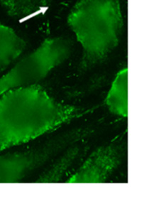 7..7. GSK3β gátlása csökkenti a forskolin HPAEC sejtekree kifejtett védő hatását trombinnal szemben.