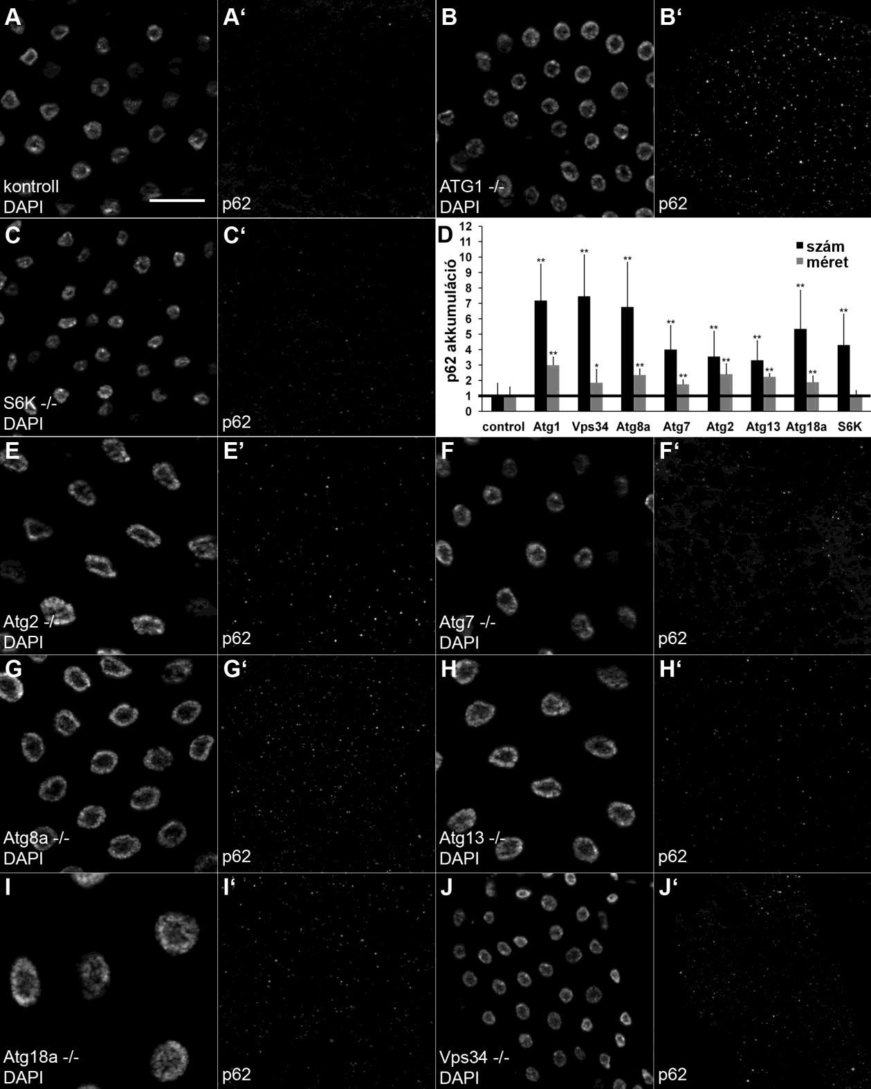 24. ábra Az endogén p62 felhalmozódása S6K és különböző Atg-mutánsok zsírtestsejtjeiben. Az A képen látható skála 30 µm-nek felel meg az A, B, C, E, F, G, H, I, J paneleken.