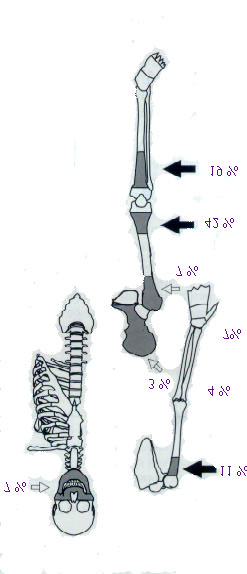 5. HAGYOMÁNYOS PROGNOSZTIKAI FAKTOROK VIZSGÁLATA OSTEOSARCOMÁBAN 5.1.1. Bevezetés, klasszifikáció, epidemiológiai adatok A csontok primer malignus daganatai a tumorok kb. 0.5-1%-át képezik.