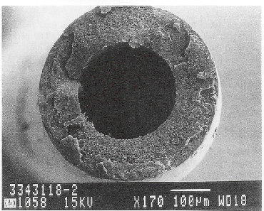 cross-section of hollow fiber membrane (magnification: 1000 ); (c) the partial