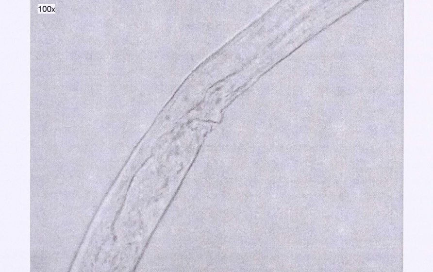 BURSAPHELENCHUS MUCRONA TUS ÉS B. VALLESIANUS MAGYARORSZÁGI JELENLÉTE 8. ábra. Bursaphelenchus mucronatus (Káptalanfa) hím farki vége spiculummal (Fotó: TÓTHÁ.). Figure 8.