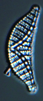 Iskolakultúra 2014/11 12 Fotó Forrás Fajnév Morfológiai leírás Autökológia Lengyel Edina (Borsodi-dűlő) Hantzschia amphioxys A magányos sejteknek jellegzetes formájuk van: a rövidebb tengelyre