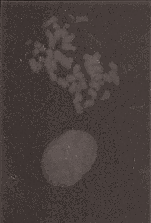 342 1. ábra. A fluoreszcencia in situ hibridizáció sematikus ábrázolása. a. A dupla szálú DNS-molekula megfelelõ denaturálási hõmérsékleten egyszálúvá alakul át. b.