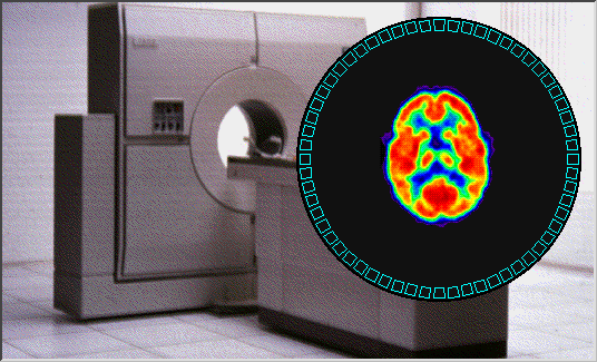 CT - Computed Tomography CT (Computed Tomography) Ipari CT-alkalmazások: hegesztések, varratok vizsgálata roncsolásmentes vizsgálatok (pl. alkatrészek) anyagvizsgálat (ld.