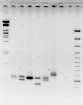 lambda PstI 100 bp ladder Molekuláris biológia gyakorlat elválasztás agaróz gélen hallgatói minták rosszabb