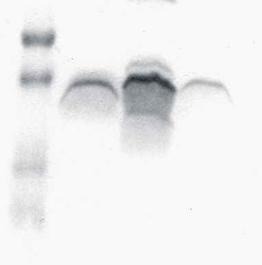 kda 22 16 M His His His 1 2 3 6 4 24. ábra.: A tisztított PemIK fehérjék komplex képzésének vizsgálata. M: molekulatömeg marker. 1. PemI (Nhis), 2. PemI és PemK (Chis), 3.