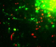 Poszt-Golgi transzport kompartmentumok: Membrán nanocsövek Mikrotubulusok és az Endoplazmatikus