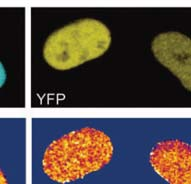 FRET A gerjesztett donor (D) relaxációjához hozzájárul az akceptor (A) molekula emissziója! hν hν + - D E ~ k FRET ~ 1/R 6 A - + R hν A FRET feltételei Fluoreszcens donor és akceptor molekula.