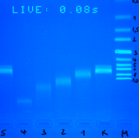 Elektroforézis A DNS protein kölcsönhatás bizonyítása EMSA (electrophoretic mobility shift assay).