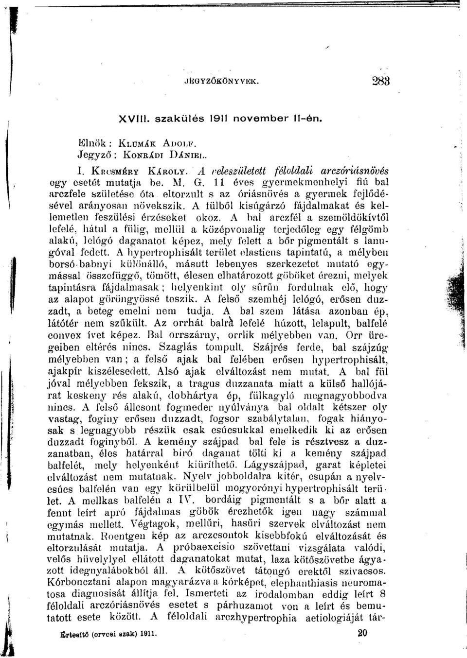 A bal arczfél a szemöldökívtől lefelé, hátul a fülig, mellül a középvonalig terjedőleg egy félgömb alakú, lelógó daganatot képez, mely felett a bőr pigmentált s lanugóval fedett.