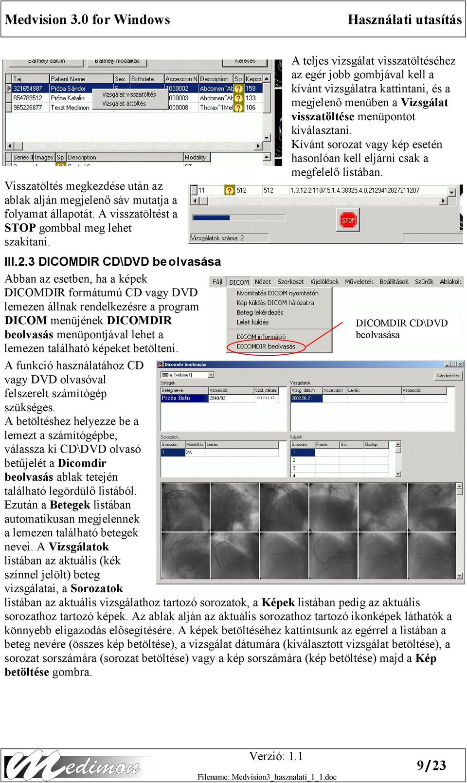 található képeket betölteni. A funkció használatához CD vagy DVD olvasóval felszerelt számítógép szükséges.