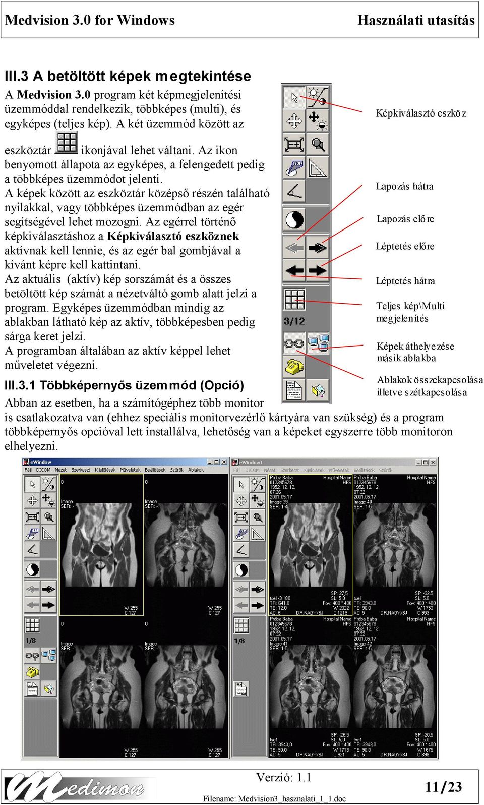 A képek között az eszköztár középső részén található nyilakkal, vagy többképes üzemmódban az egér segítségével lehet mozogni.