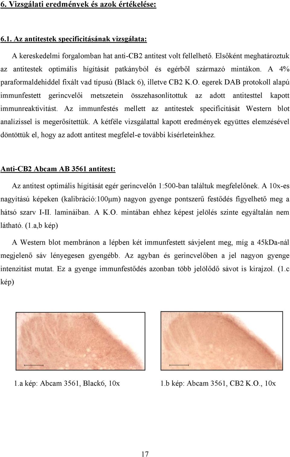 egerek DAB protokoll alapú immunfestett gerincvelői metszetein összehasonlítottuk az adott antitesttel kapott immunreaktivitást.