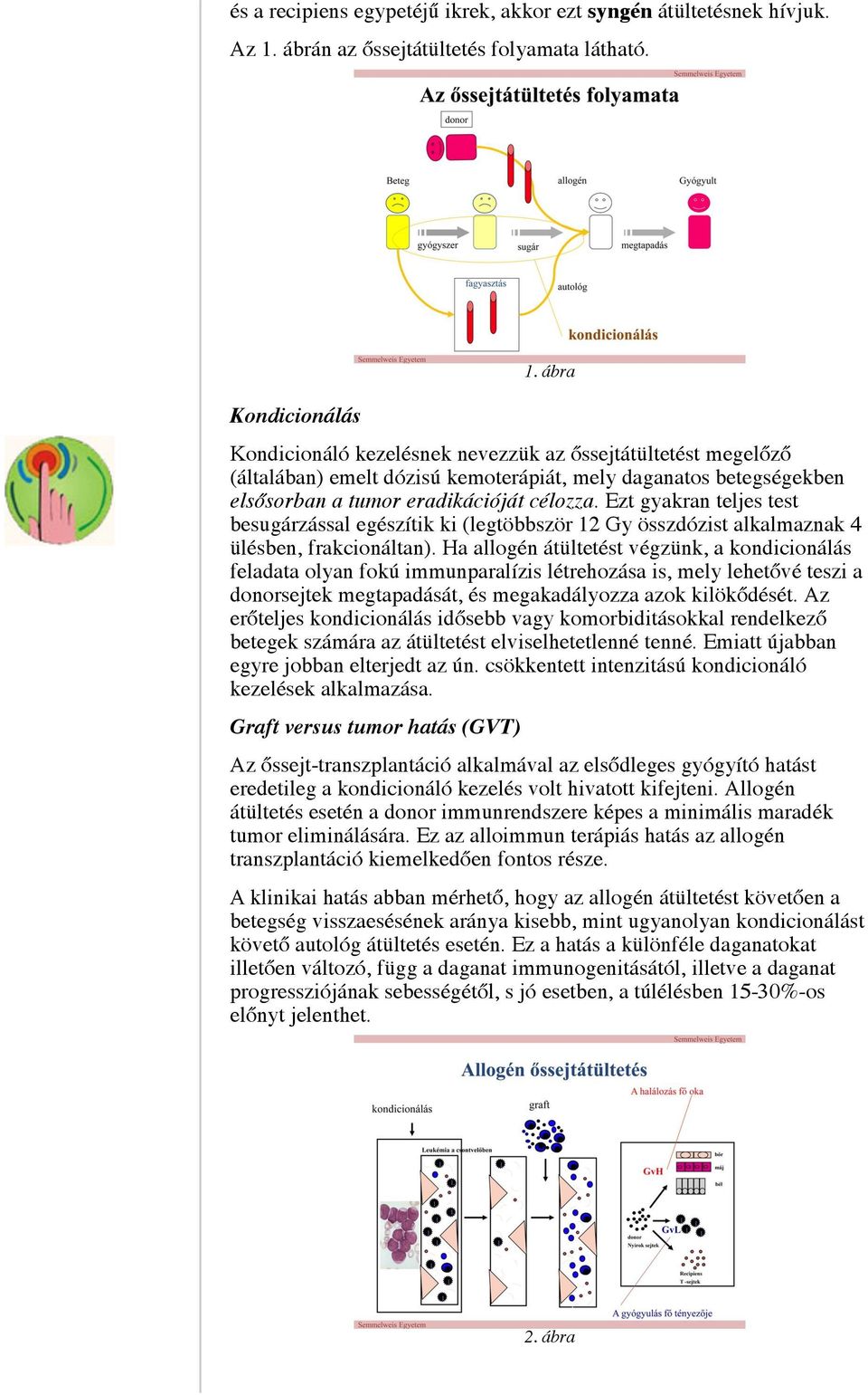 Ezt gyakran teljes test besugárzással egészítik ki (legtöbbször 12 Gy összdózist alkalmaznak 4 ülésben, frakcionáltan).