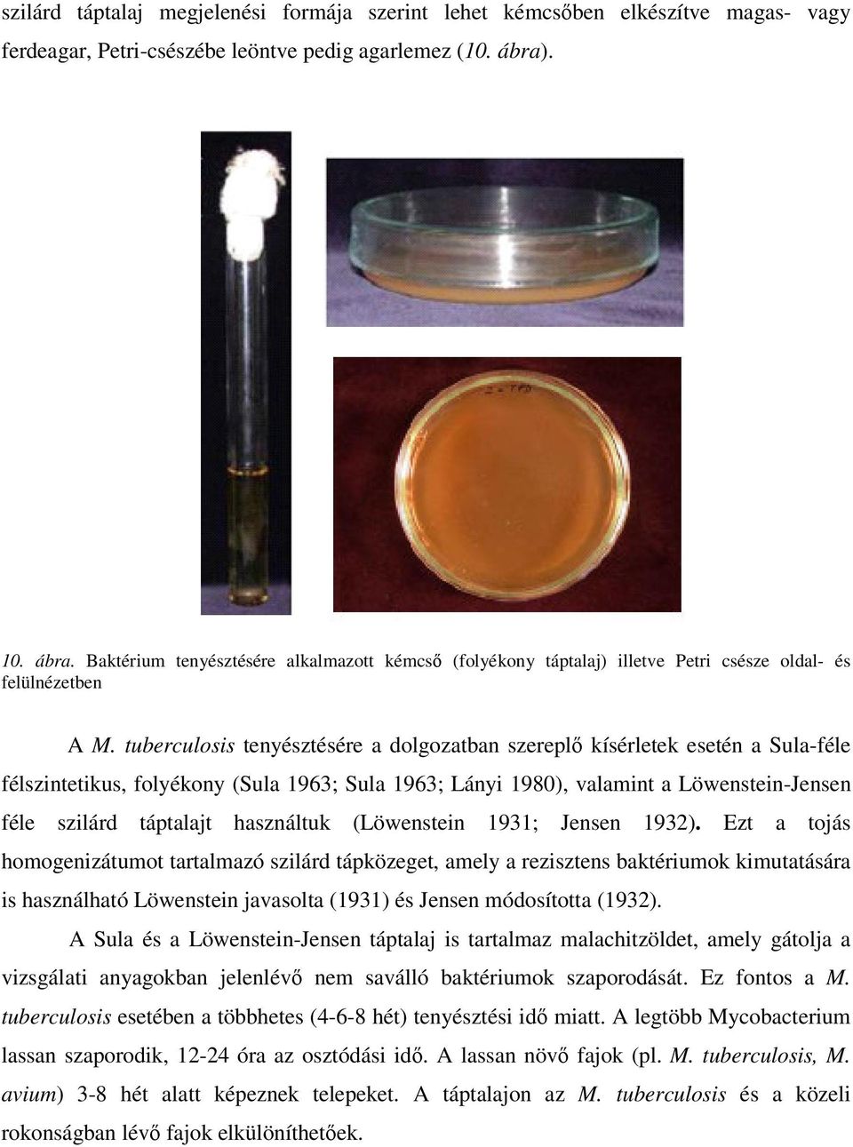 tuberculosis tenyésztésére a dolgozatban szerepl kísérletek esetén a Sula-féle félszintetikus, folyékony (Sula 1963; Sula 1963; Lányi 1980), valamint a Löwenstein-Jensen féle szilárd táptalajt