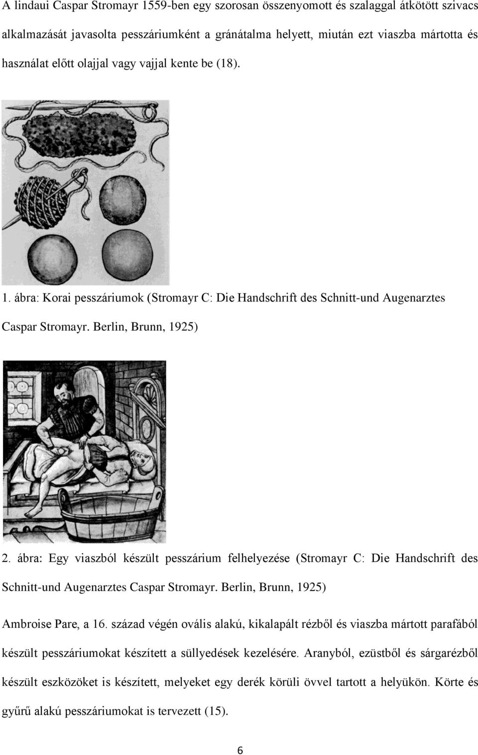ábra: Egy viaszból készült pesszárium felhelyezése (Stromayr C: Die Handschrift des Schnitt-und Augenarztes Caspar Stromayr. Berlin, Brunn, 1925) Ambroise Pare, a 16.