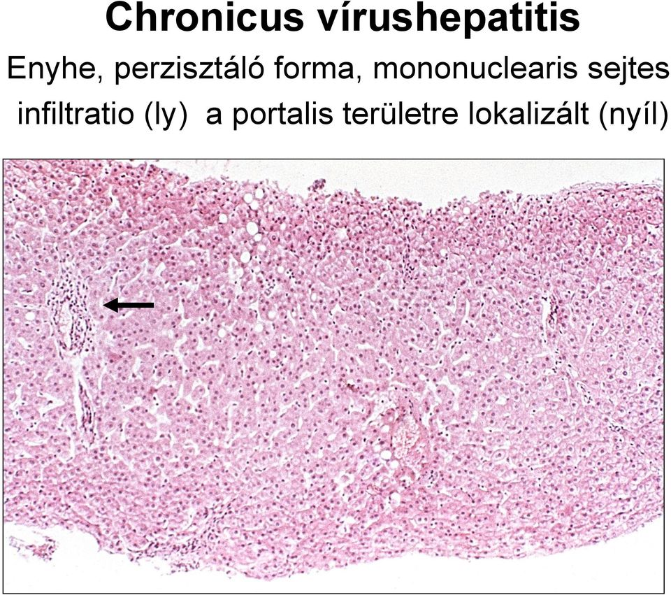 mononuclearis sejtes