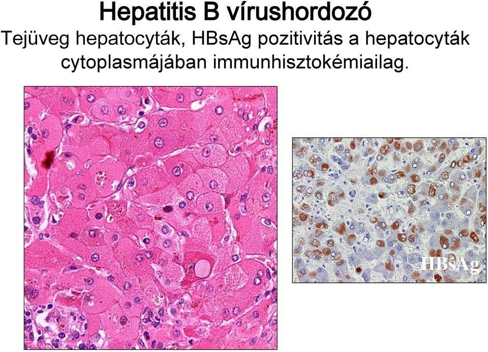 pozitivitás a hepatocyták