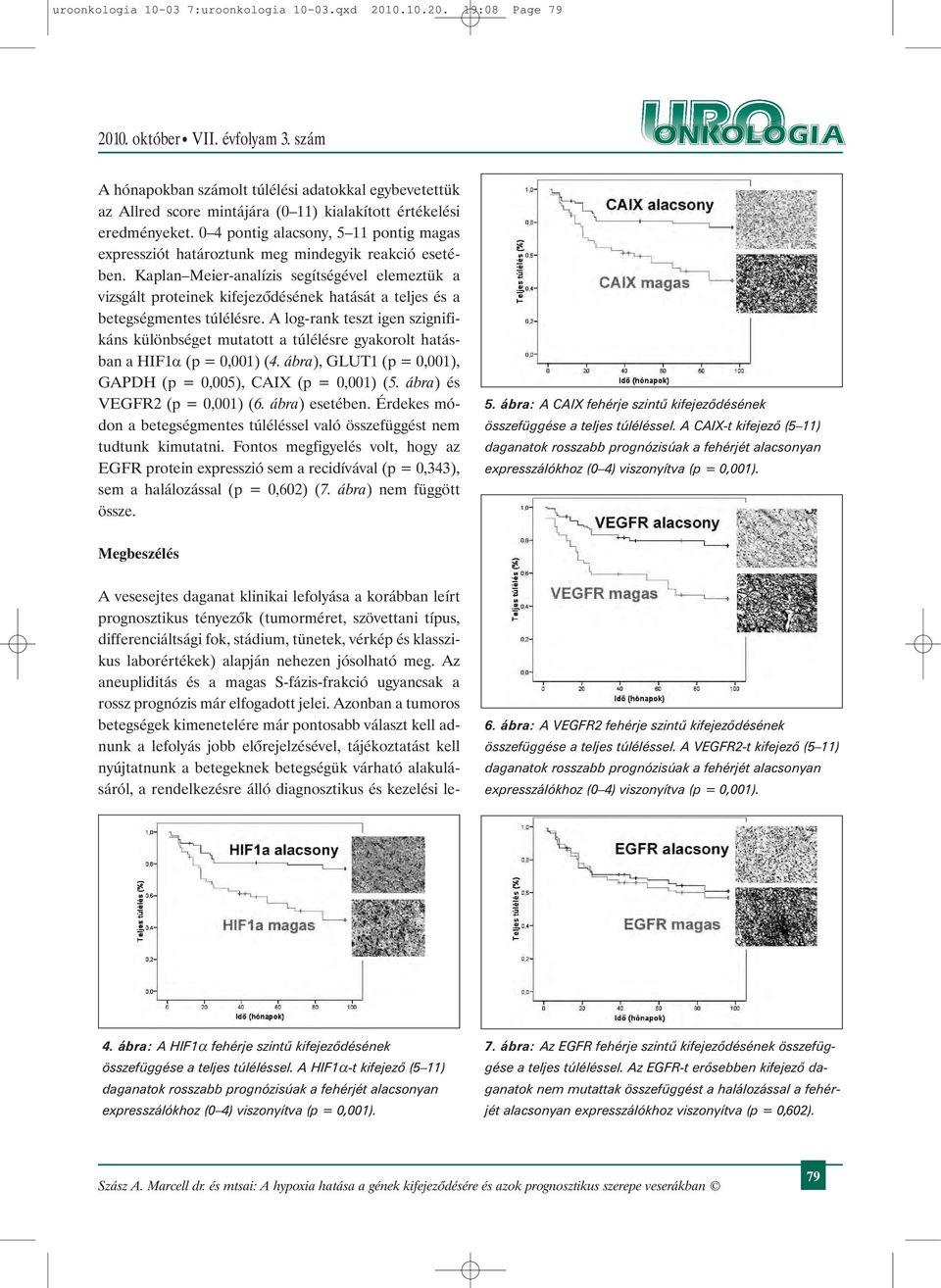 Kaplan Meier-analízis segítségével elemeztük a vizsgált proteinek kifejezõdésének hatását a teljes és a betegségmentes túlélésre.