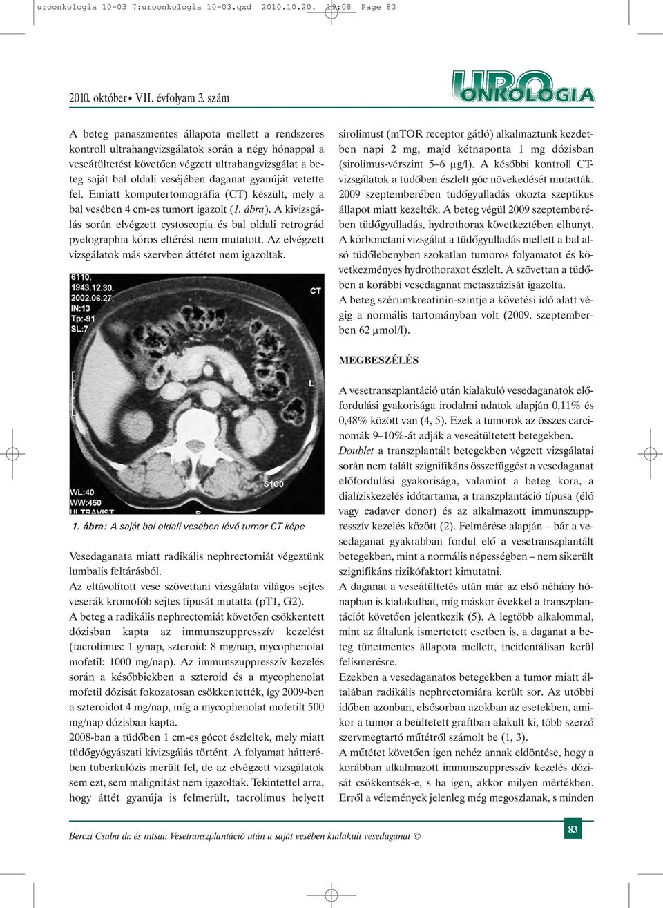 19:08 Page 83 A beteg panaszmentes állapota mellett a rendszeres kontroll ultrahangvizsgálatok során a négy hónappal a veseátültetést követõen végzett ultrahangvizsgálat a beteg saját bal oldali