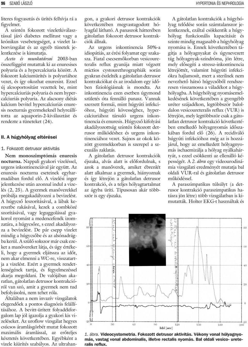 Aceto és munkatársai 2003-ban összefüggést mutattak ki az enuresises polyuria és a hypercalciuria között. A fokozott kalciumürítés is polyuriához vezet, és így okozhat enuresist.