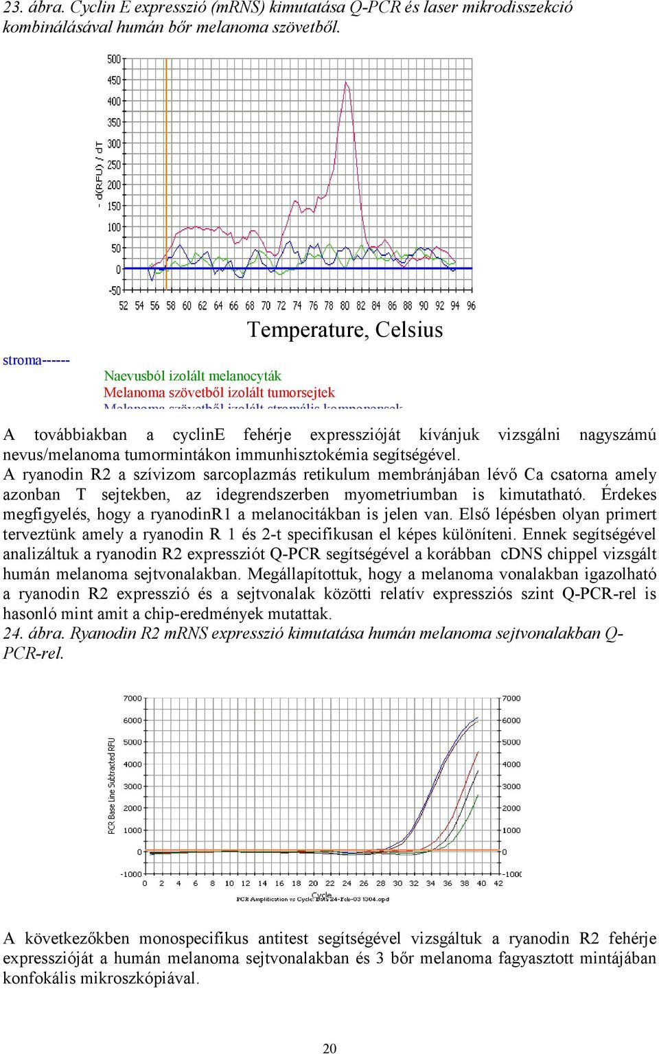 kívánjuk vizsgálni nagyszámú nevus/melanoma tumormintákon immunhisztokémia segítségével.