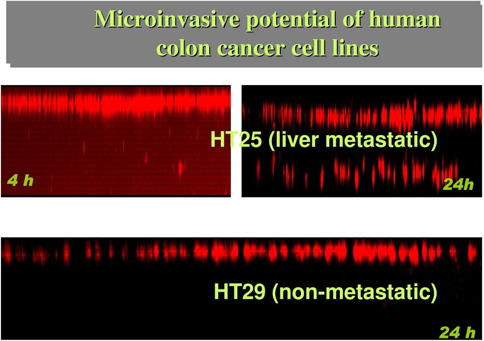 lines HT25 (liver