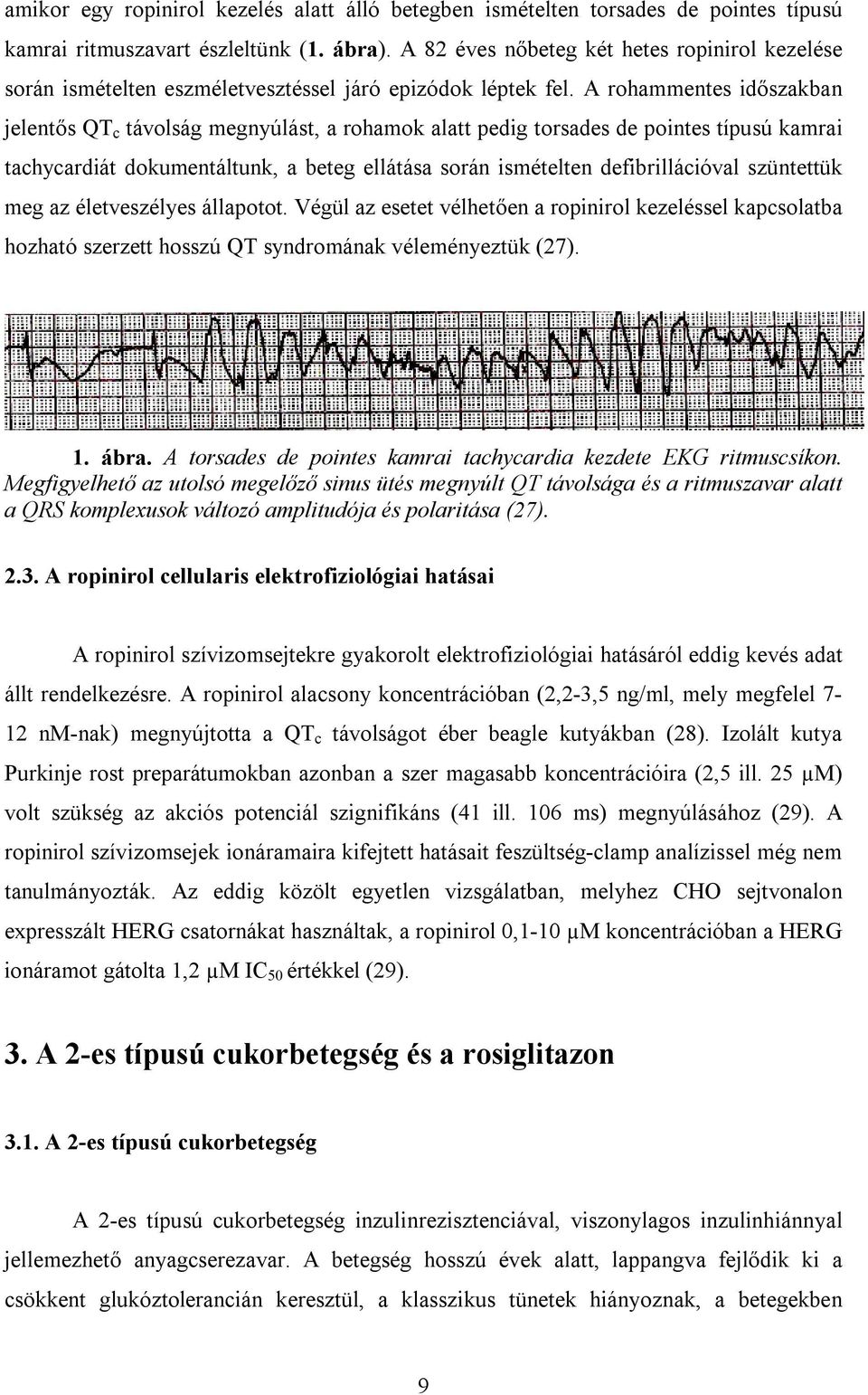 A rohammentes időszakban jelentős QT c távolság megnyúlást, a rohamok alatt pedig torsades de pointes típusú kamrai tachycardiát dokumentáltunk, a beteg ellátása során ismételten defibrillációval