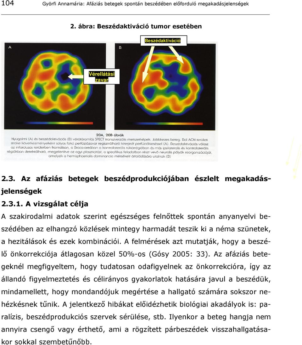 A vizsgálat célja A szakirodalmi adatok szerint egészséges felnőttek spontán anyanyelvi beszédében az elhangzó közlések mintegy harmadát teszik ki a néma szünetek, a hezitálások és ezek kombinációi.