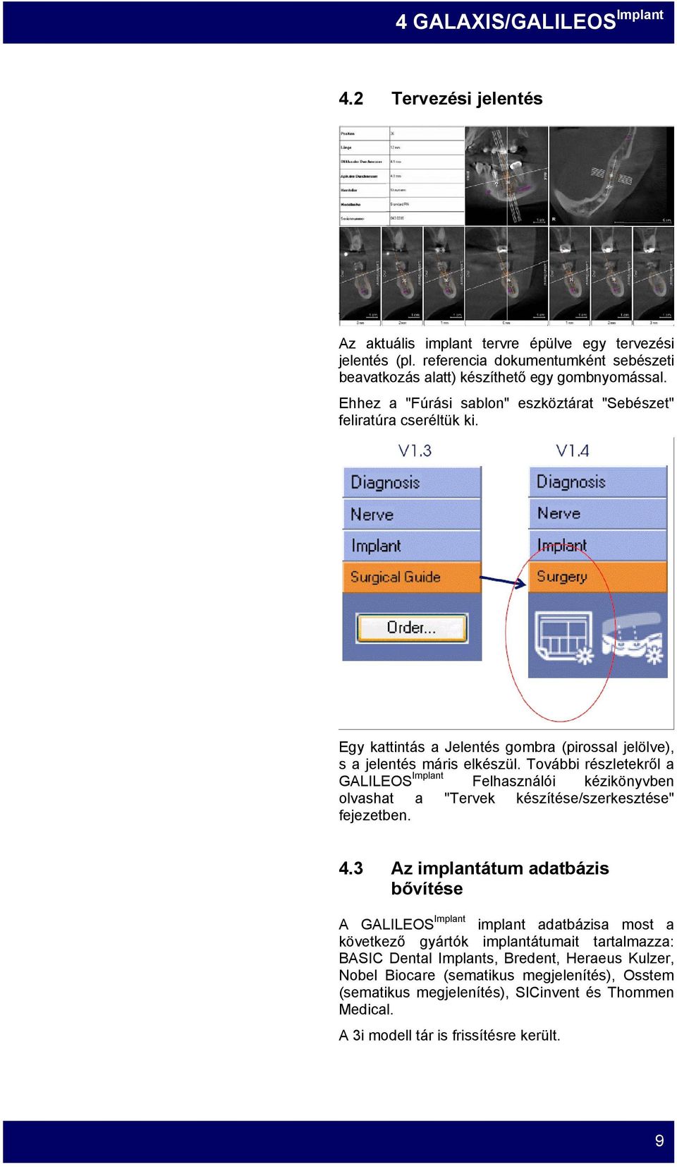 További részletekről a GALILEOS Implant Felhasználói kézikönyvben olvashat a "Tervek készítése/szerkesztése" fejezetben. 4.