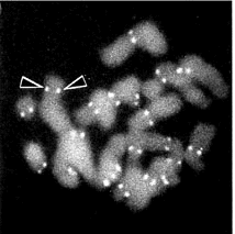 V. A kromoszóma szerkezete A diploid (emberi) sejt 6.2 pg-nyi DNS-ét a 46 kromoszóma átlagosan 4 cm hoszúságú DNS molekulája alkotja. Az ábrán egy metafázis kromoszóma sémás szerkezete látható.