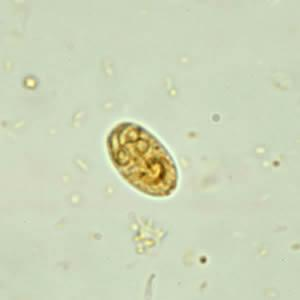 Giardia intestinalis (G. lamblia) Az ovális cystára jellemző a tengelyfonal, továbbá ennek két oldalán elhelyezkedő kettő-kettő mag. Mérete 8-19 µm...... http://www.dpd.cdc.