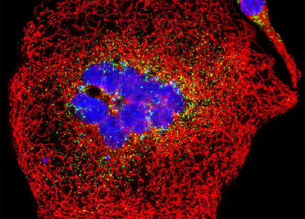 Fluoreszcencia mikroszkóp HeLasejtek: peroxiszóma EGFP,