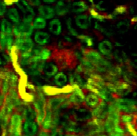 GREEN: autofluorescence from NADH RED: 70 kda rhodamin dextrane (blood vessels) YELLOW: Lucifer