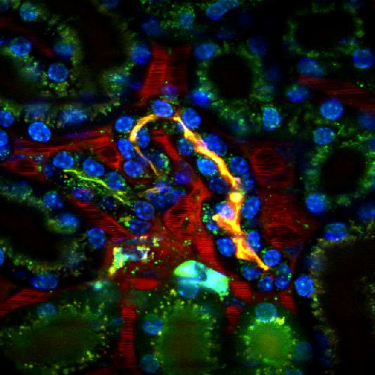 Renin termelődés a vesében immunoszupresszáns kezelést követően multifoton mikroszkópia Tac kezelt gyűjtőcsatorna glomerulus + JGA