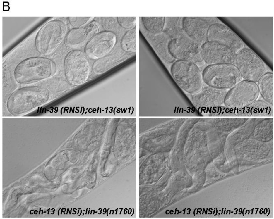 21. ábra. A ceh-13 és lin-39 együttes inaktiválása által okozott szintetikus fenotípusok. (A) A bal felsı panelen egy vad típusú hermafrodita csíravonalának egy része látható.